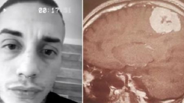 Francesco Chiofalo: l'operazione &egrave; andata a buon fine, adesso &egrave; cosciente