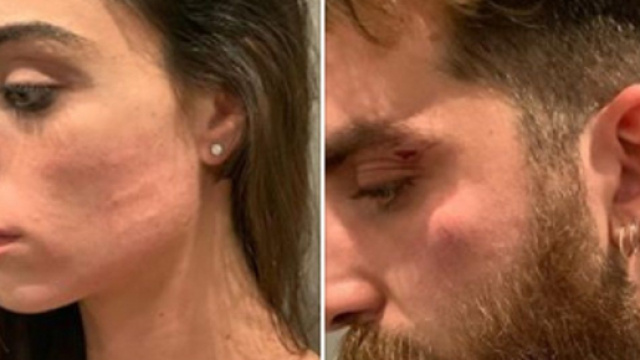 Lorella Boccia di Amici su IG: 'Io e mio marito aggrediti e derubati da uomini di m...'