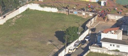Menino de 10 anos foi atacado por seis c&atilde;es em SP. (Reprodu&ccedil;&atilde;o/Rede Globo)