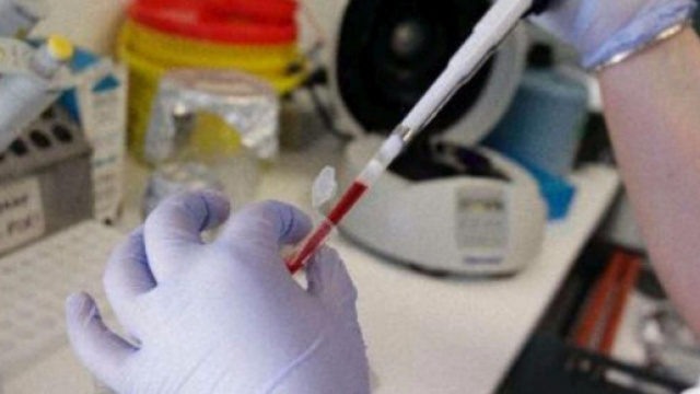 Brescia, l'autopsia rivela che Veronica non &egrave; morta di meningite.