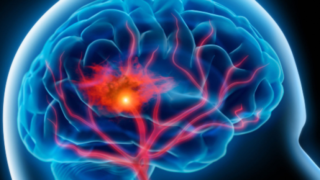 Spagna, direttore di banca compie gesti di autoerotismo davanti ai famigliari: aveva un ictus