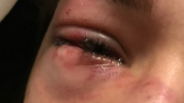 Bolzano, ragazza di 15 anni aggredita da compagne di classe