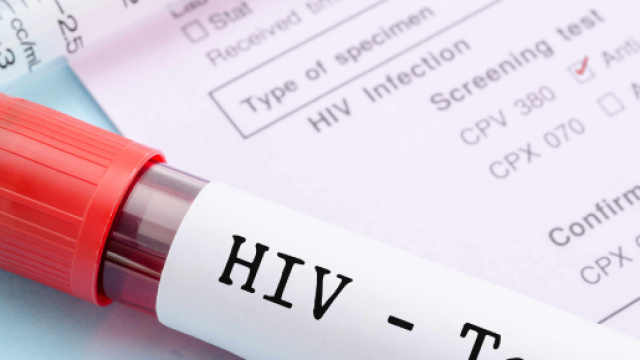 HIV: nel 2019 parte la sperimentazione vaccino terapeutico ... - ilpapaverorossoweb.it
