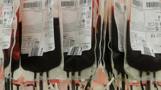 Bergamo: donatore si ritira giovane medico stroncato da leucemia