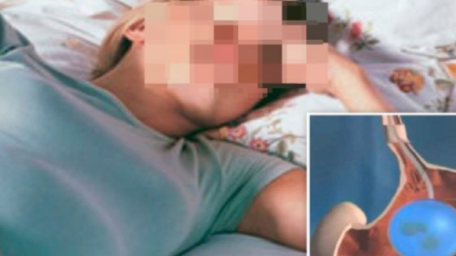Sicilia, 40enne ingerisce palloncino gastrico per dimagrire. Muore tra dolori atroci - Teleclubitalia