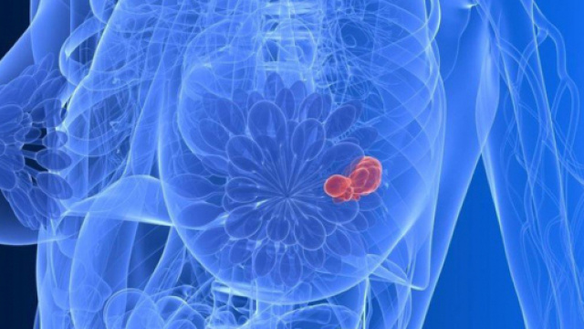 Invalidit&agrave; civile per le donne sane Brca positive
