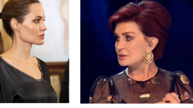 Molte star, come Angelina Jolie e Sharon Osbourne, con il gene BRCA1 mutato, si sono sottoposte ad un intervento di mastectomia preventivo.