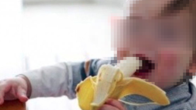 Civitavecchia, frammento di banana di traverso: bimba di due anni in fin di vita - Teleclubitalia