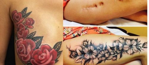 Belas tatuagens para esconder marcas no corpo.(Foto/Reprodu&ccedil;&atilde;o via Incr&iacute;vel Club).