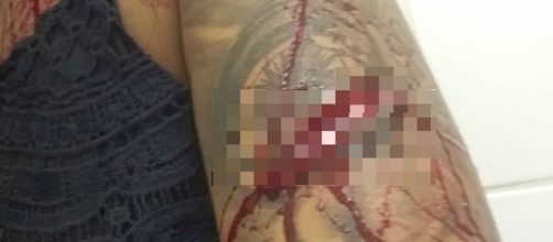 Ci&uacute;mes teriam motivado agress&atilde;o contra a modelo. (Arquivo pessoal)