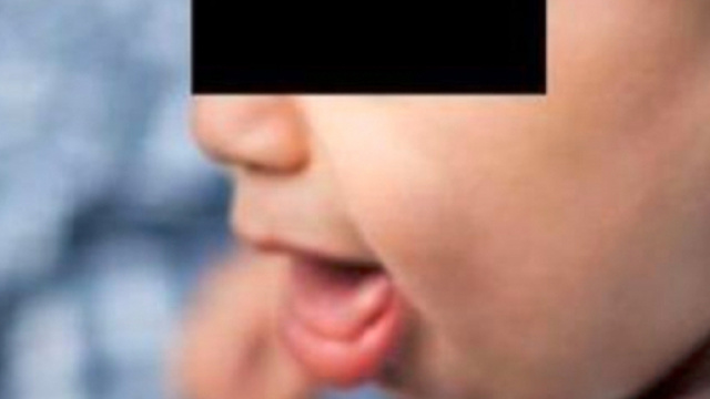 Napoli, bimbo di un anno muore soffocato forse per un rigurgito: inutili i soccorsi.