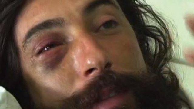 Trani, Brumotti aggredito durante un servizio sullo spaccio