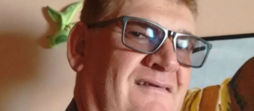 Homem teve mais de 80% do corpo queimado. (Cr&eacute;dito: Foto/Arquivo Pessoal).