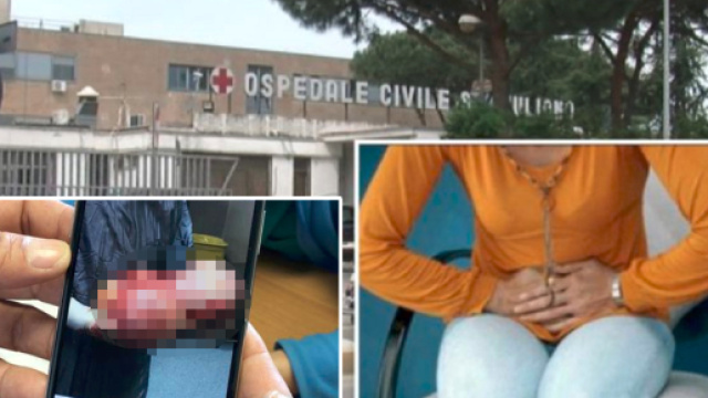 Sembrava incinta, napoletana salvata a 17 anni da tumore gigante