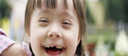 Dia Internacional da S&iacute;ndorme de Down (Foto:Arquivo/ Blasting News)