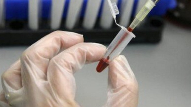 Con le cellule staminali si pu&ograve; sconfiggere l'AIDS (fonte viverepiusani.it)