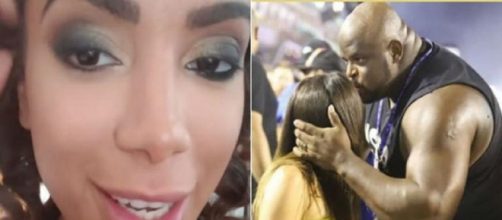 Anitta exibe machucado na cabe&ccedil;a (Foto: Reprodu&ccedil;&atilde;o/ Instagram)