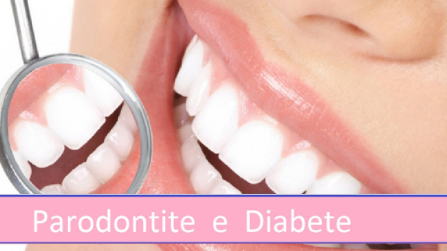La piorrea &egrave; una delle patologie pi&ugrave; diffuse al mondo, causata da una disbiosi orale. Condizione che peggiora nei pazienti diabetici.