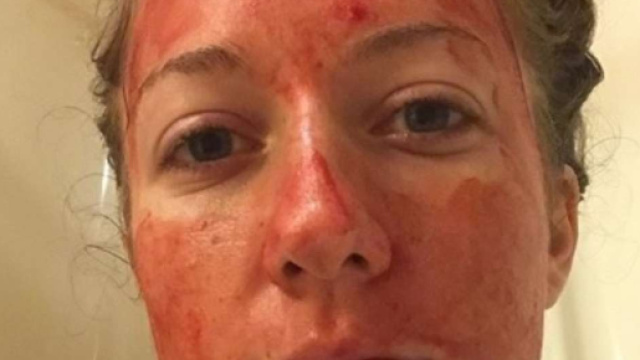 USA, ragazza si cosparge il volto con il sangue mestruale per sfatare un taboo