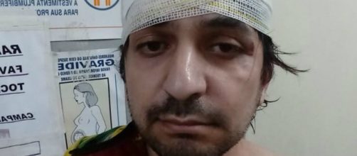 Leandro Mohallem &eacute; v&iacute;tima de agress&atilde;o. (Reprodu&ccedil;&atilde;o/Twitter/@CarlaZambelli17)