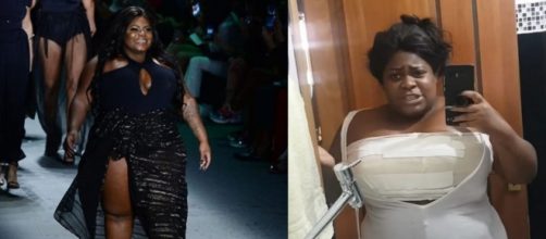 Jojo Todynho se recupera de cirurgia realizada para corre&ccedil;&atilde;o das mamas. (Reprodu&ccedil;&atilde;o/Instagram/@jojotodynho)