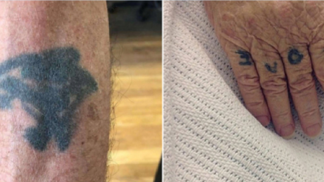 Exemples de tatouages qui avec le temps ont mal vieillis