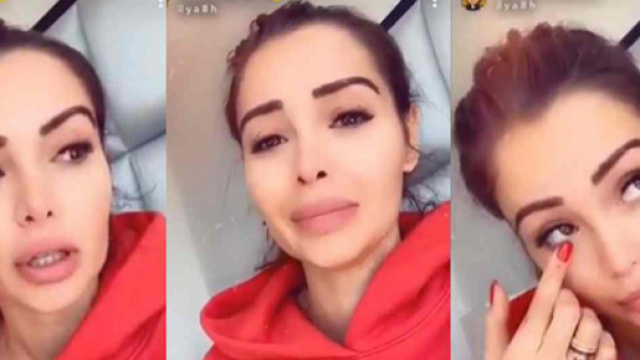 Nabilla 'au bout de sa vie' &agrave; cause de la grossesse, elle d&eacute;voile son visage couvert de boutons.