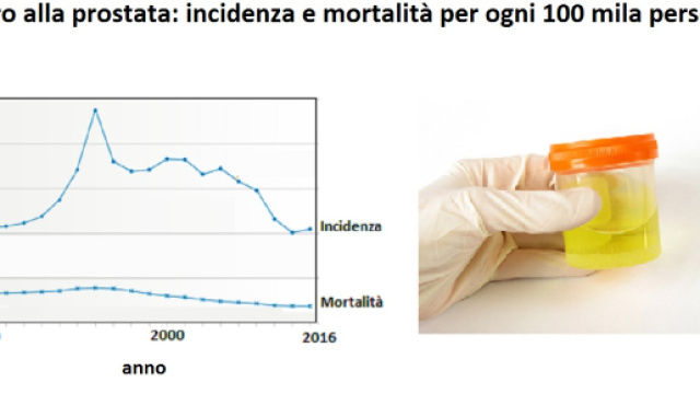 L&rsquo;incidenza di questo tumore &egrave; come nel 1980 mentre la mortalit&agrave; &egrave; inferiore al 10%. Un test delle urine consentir&agrave; una diagnosi precoce.