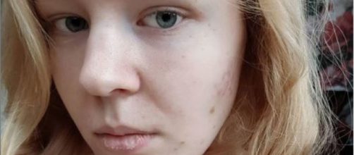 Noa Pothoven, solicit&oacute; la eutanasia al no poder aguantar los traumas por haber sido violada