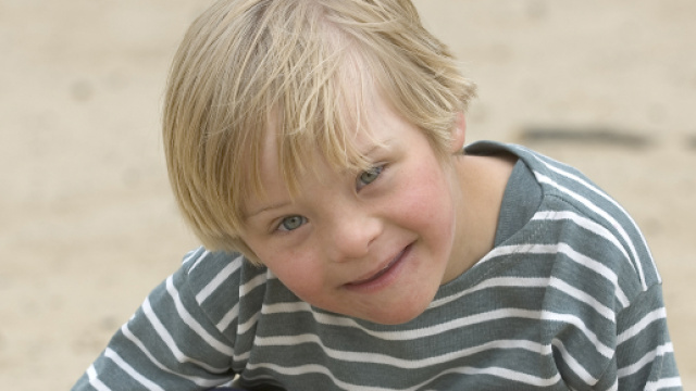 Existe t-il diff&eacute;rentes formes de trisomie 21 ? - hizy.org