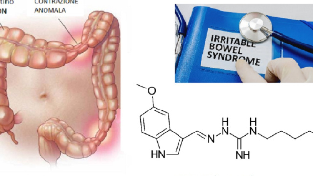 Acquisito da Alfasigma USA un farmaco, per ora destinato al mercato statunitense, per il trattamento della IBS-C.