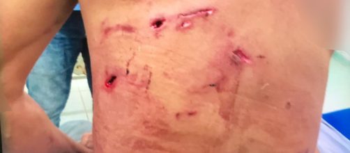 Homem foi atacado por on&ccedil;a. (Divulga&ccedil;&atilde;o/Corpo de Bombeiro)