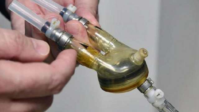 Torino, cuore artificiale per 18 mesi: trapianto salva bimbo di tre anni | ilmessaggero.it