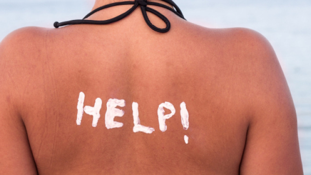 Soulager un coup de soleil : 5 rem&egrave;des naturels facile &agrave; faire ... - topsante.com