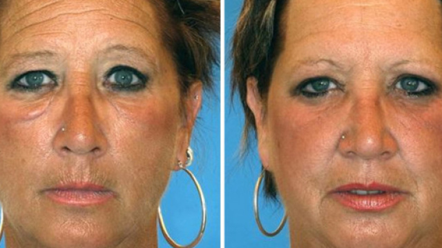 photos entre jumelles et jumeaux qui fument et ne fument pas - photo publi&eacute;e par Ohmymag