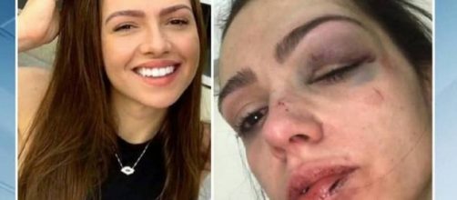 Vendedora sofre agress&atilde;o em casa noturna (Reprodu&ccedil;&atilde;o/Record TV)