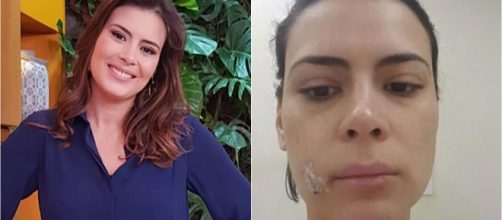Logo ap&oacute;s o incidente, apresentadora teria procurado aux&iacute;lio m&eacute;dico. (Reprodu&ccedil;&atilde;o/Instagram/@michelleloretoap)