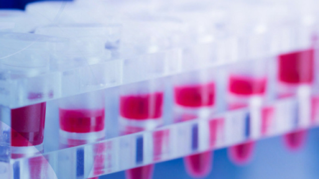 Car T, la cura per i tumori del sangue