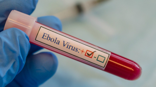 Russia, esplosione in un laboratorio che contiene virus letali