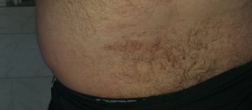 Motorista ficou com v&aacute;rios hematomas. (Arquivo Pessoal)