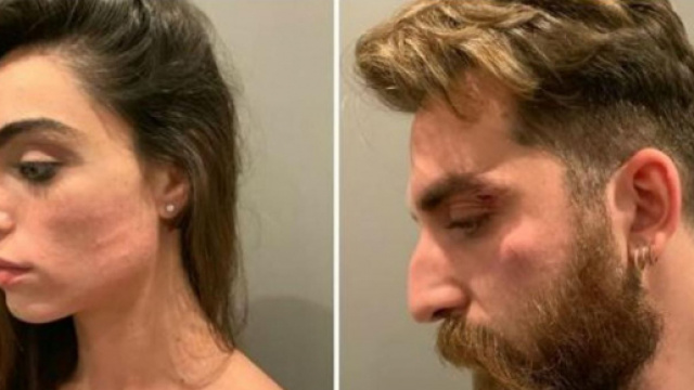 Lorella Boccia e il marito aggrediti e rapinati: 'Ci hanno intimidito con un coltello'