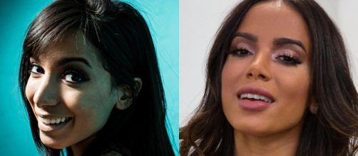 Anitta est&aacute; bem diferente do que era antes das pl&aacute;sticas. (Arquivo Blasting News)