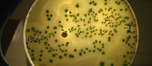 Las 5 bacterias m&aacute;s comunes en los alimentos