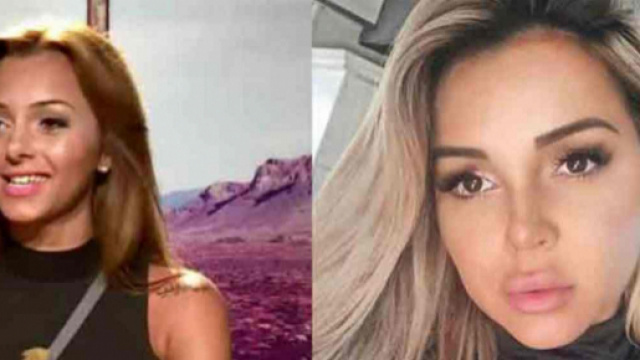 La Bataille des Couples 2 : Fidji Ruiz d&eacute;voile les r&eacute;sultats de sa nouvelle chirurgie esth&eacute;tique, une r&eacute;duction mammaire.