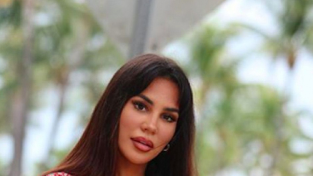 Milla Jasmine accus&eacute;e d'abuser de la chirurgie esth&eacute;tique par les internautes. Credit: Instagram/millajasmineoff