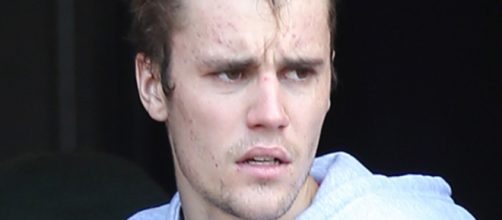 Doen&ccedil;a de Justin Bieber n&atilde;o tem cura. (Arquivo Blasting News)