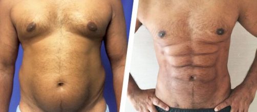 Apenas abdominais n&atilde;o s&atilde;o suficientes. (Arquivo Blasting News)