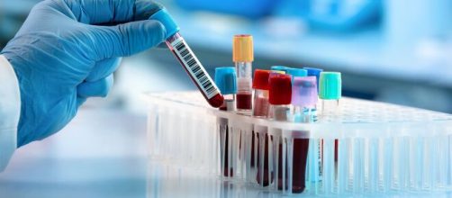 El grupo 0 en la sangre ofrece mayor resistencia al virus