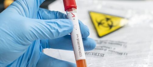 Exame de sangue pode prever quem desenvolver&aacute; covid-19 grave. (Arquivo Blasting News)