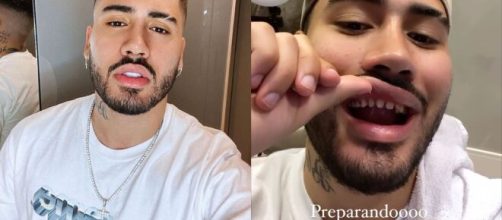 Kevinho j&aacute; mostrou seus dentes sem as lentes de contato. (Arquivo Blasting News)